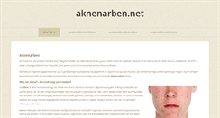 Desktop Screenshot of aknenarben.net