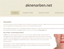 Tablet Screenshot of aknenarben.net